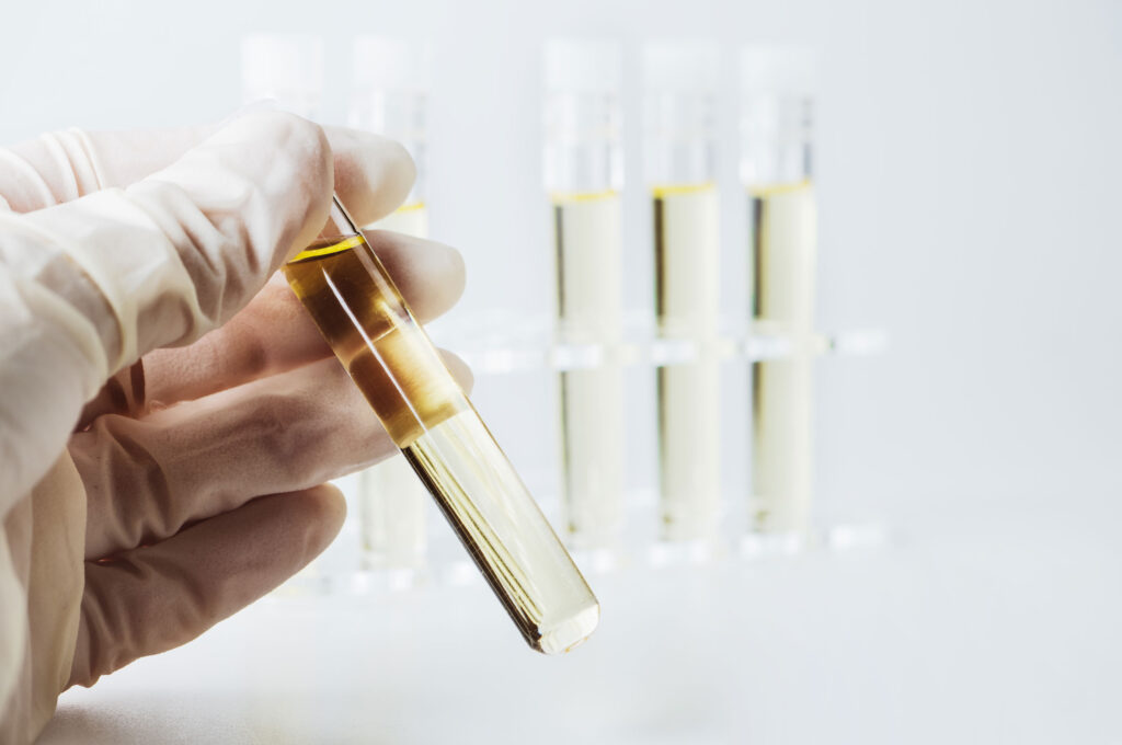 oil flask tubes gloved hand