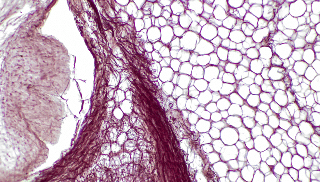 scaffold close up